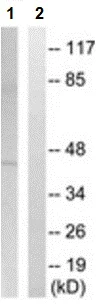 Western blot - Anti-AGPAT3 antibody (AB211435)