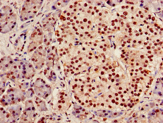 Immunohistochemistry (Formalin/PFA-fixed paraffin-embedded sections) - Anti-AGPAT5 antibody (AB236541)