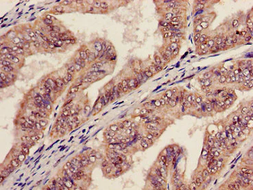 Immunohistochemistry (Formalin/PFA-fixed paraffin-embedded sections) - Anti-AGPAT5 antibody (AB236541)