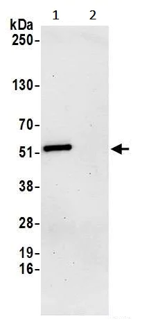 Immunoprecipitation - Anti-AGPAT7 antibody (AB242087)