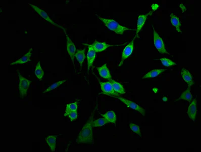 Immunocytochemistry/ Immunofluorescence - Anti-AGPS antibody (AB236621)