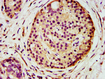 Immunohistochemistry (Formalin/PFA-fixed paraffin-embedded sections) - Anti-AGPS antibody (AB236621)