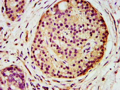 Immunohistochemistry (Formalin/PFA-fixed paraffin-embedded sections) - Anti-AGPS antibody (AB236621)