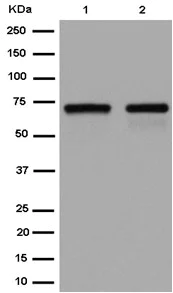 Western blot - Anti-AGPS antibody [EPR13120] - N-terminal (AB184186)