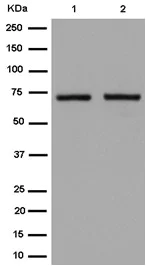 Western blot - Anti-AGPS antibody [EPR13120] - N-terminal (AB184186)
