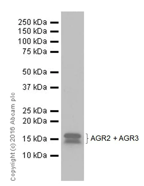 Western blot - Anti-AGR2 + AGR3 antibody [EPR20164-222] (AB216071)