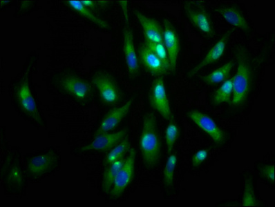 Immunocytochemistry/ Immunofluorescence - Anti-Agrin antibody (AB236652)