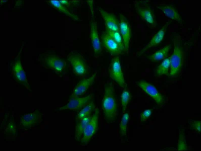 Immunocytochemistry/ Immunofluorescence - Anti-Agrin antibody (AB236652)