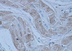 Immunohistochemistry (Formalin/PFA-fixed paraffin-embedded sections) - Anti-Agrin antibody (AB85174)