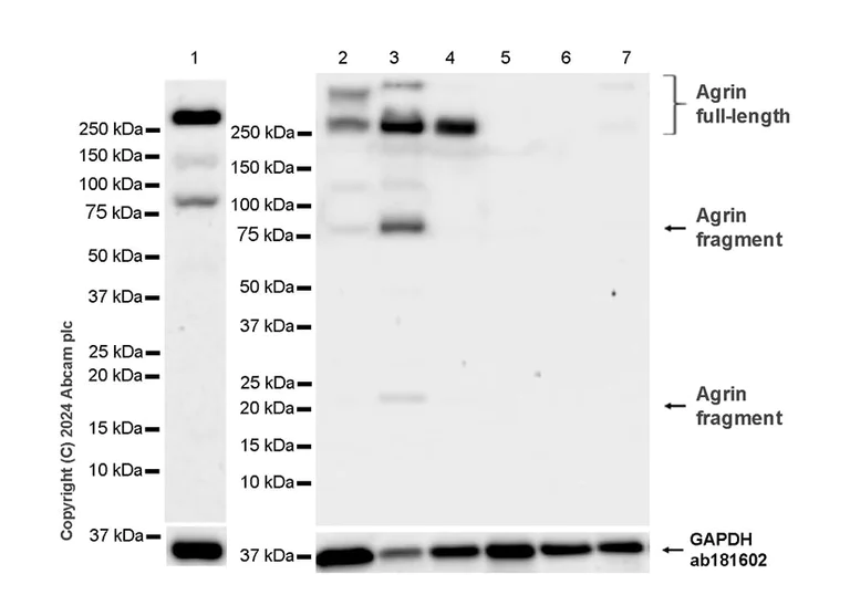 Western blot - Anti-Agrin antibody [EPR28044-241] - BSA and Azide free (AB317743)