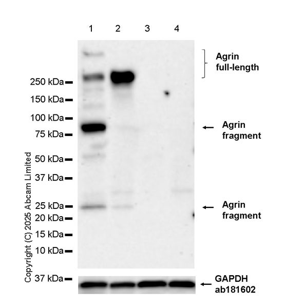 Western blot - Anti-Agrin antibody [RM2082] (AB324022), expandable thumbnail