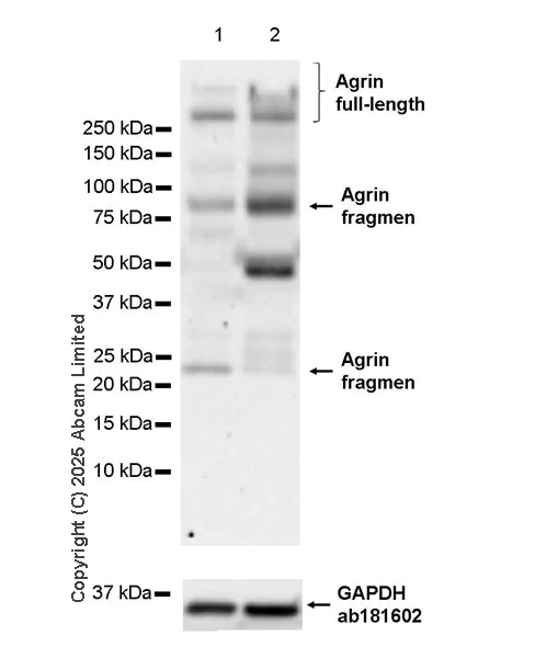 Western blot - Anti-Agrin antibody [RM2082] (AB324022)