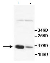 Western blot - Anti-AGRP antibody (AB113481)