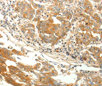 Immunohistochemistry (Formalin/PFA-fixed paraffin-embedded sections) - Anti-AGRP antibody (AB199126)