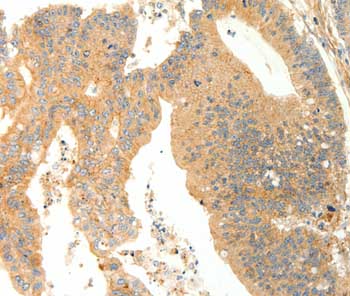 Immunohistochemistry (Formalin/PFA-fixed paraffin-embedded sections) - Anti-AGRP antibody (AB199126)