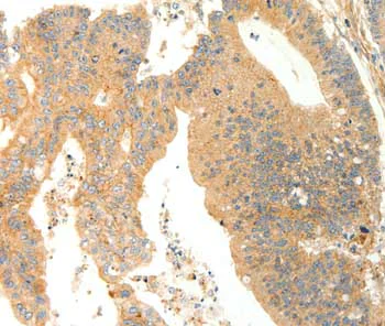 Immunohistochemistry (Formalin/PFA-fixed paraffin-embedded sections) - Anti-AGRP antibody (AB199126)