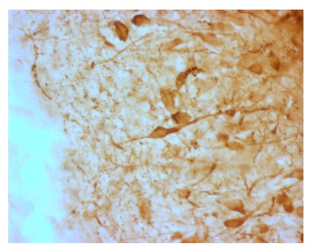 Immunohistochemistry (Frozen sections) - Anti-AGRP antibody (AB228495), expandable thumbnail