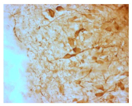 Immunohistochemistry (Frozen sections) - Anti-AGRP antibody (AB228495)