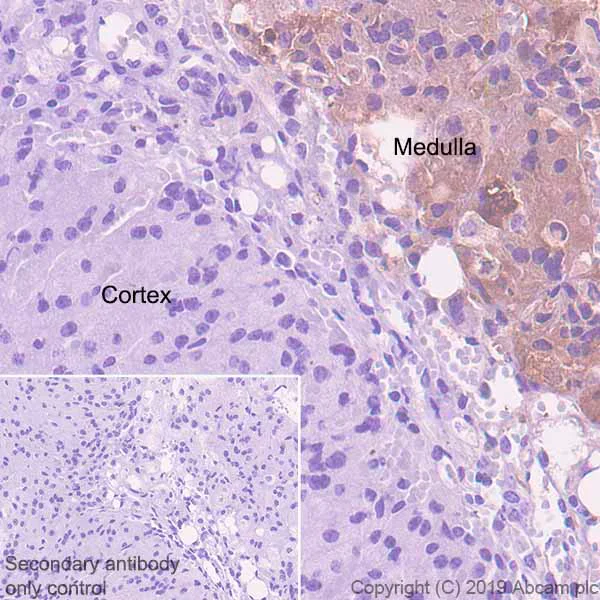 Immunohistochemistry (Formalin/PFA-fixed paraffin-embedded sections) - Anti-AGRP antibody [EPR18155-110] (AB254558)