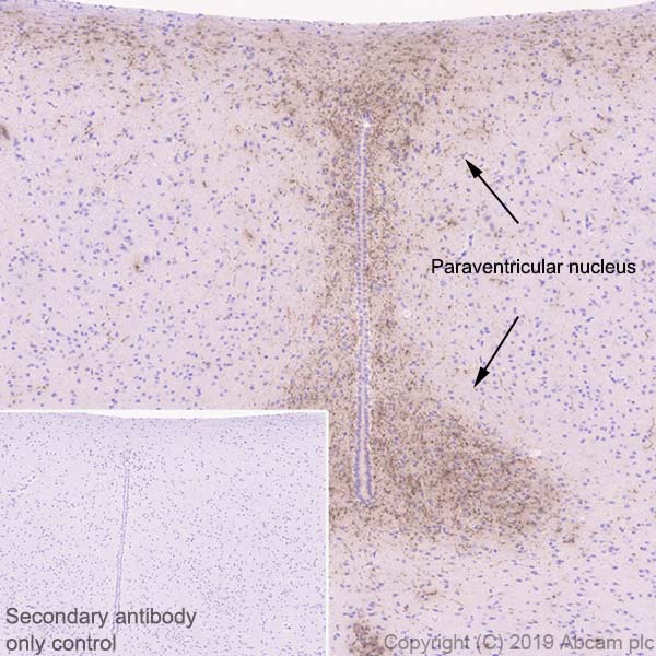 Immunohistochemistry (Formalin/PFA-fixed paraffin-embedded sections) - Anti-AGRP antibody [EPR18155-110] (AB254558)