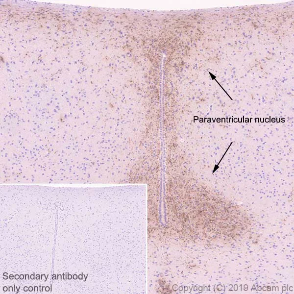Immunohistochemistry (Formalin/PFA-fixed paraffin-embedded sections) - Anti-AGRP antibody [EPR18155-110] - BSA and Azide free (AB255686)