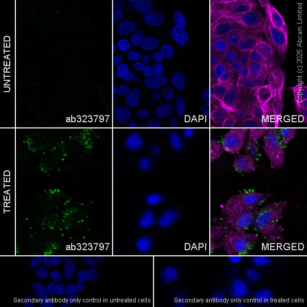 Immunocytochemistry/ Immunofluorescence - Anti-AGRP antibody [EPR22984-1] (AB323797)