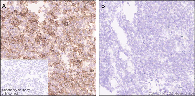 Immunohistochemistry (Formalin/PFA-fixed paraffin-embedded sections) - Anti-AGRP antibody [EPR22984-1] (AB323797)