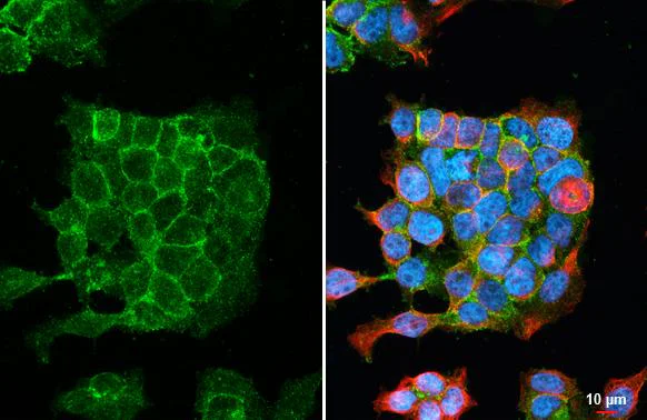 Immunocytochemistry/ Immunofluorescence - Anti-AGTR1 antibody [HL2526] - BSA and Azide free (AB325838)