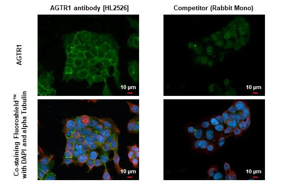Immunocytochemistry/ Immunofluorescence - Anti-AGTR1 antibody [HL2526] - BSA and Azide free (AB325838)