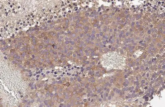 Immunohistochemistry (Formalin/PFA-fixed paraffin-embedded sections) - Anti-AGTR1 antibody [HL2526] - BSA and Azide free (AB325838)