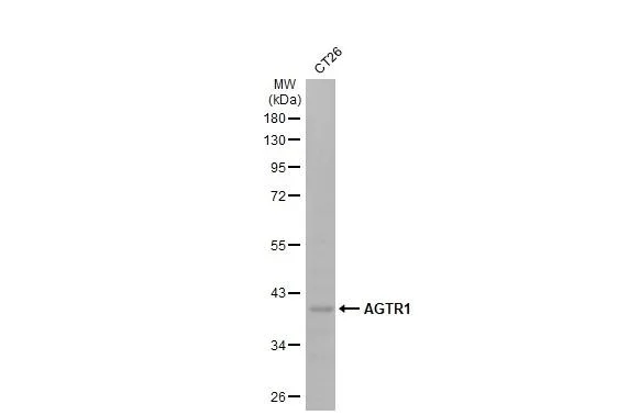 Western blot - Anti-AGTR1 antibody [HL2526] - BSA and Azide free (AB325838)