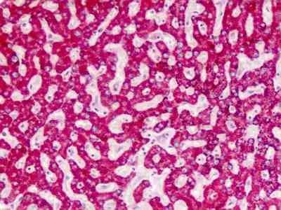 Immunohistochemistry (Formalin/PFA-fixed paraffin-embedded sections) - Anti-AGXT antibody (AB178506)
