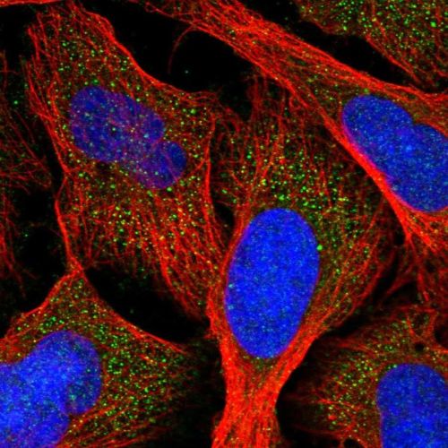 Immunocytochemistry/ Immunofluorescence - Anti-AGXT antibody (AB244450), expandable thumbnail