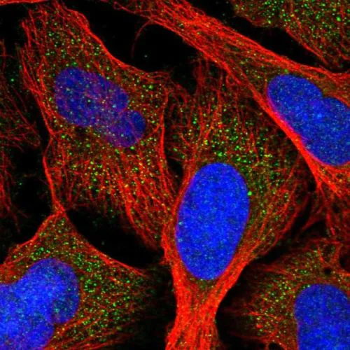 Immunocytochemistry/ Immunofluorescence - Anti-AGXT antibody (AB244450)