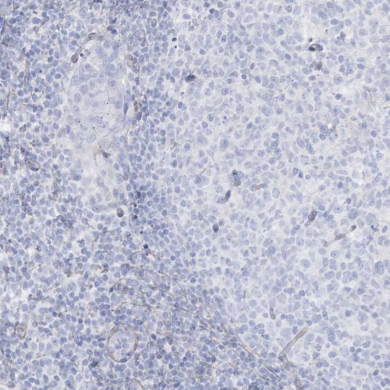 Immunohistochemistry (Formalin/PFA-fixed paraffin-embedded sections) - Anti-AGXT antibody (AB244450), expandable thumbnail