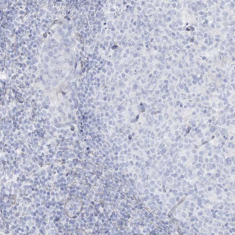 Immunohistochemistry (Formalin/PFA-fixed paraffin-embedded sections) - Anti-AGXT antibody (AB244450)