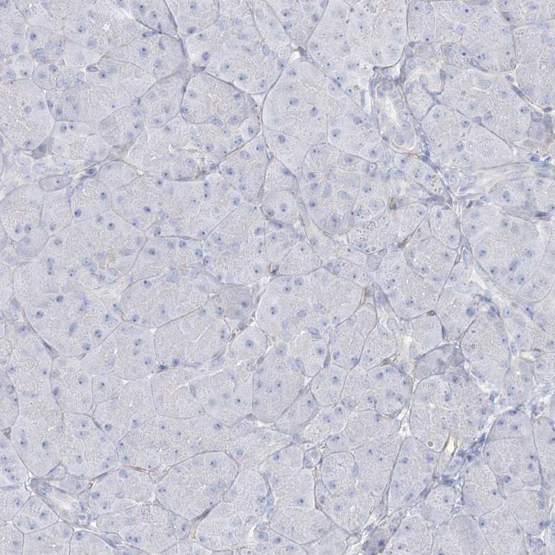 Immunohistochemistry (Formalin/PFA-fixed paraffin-embedded sections) - Anti-AGXT antibody (AB244450), expandable thumbnail