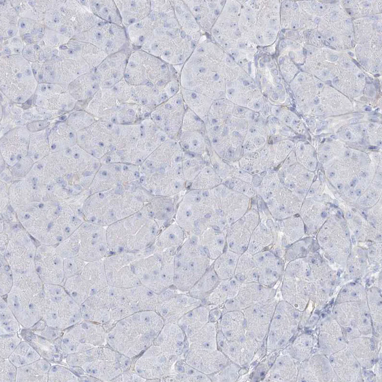 Immunohistochemistry (Formalin/PFA-fixed paraffin-embedded sections) - Anti-AGXT antibody (AB244450)