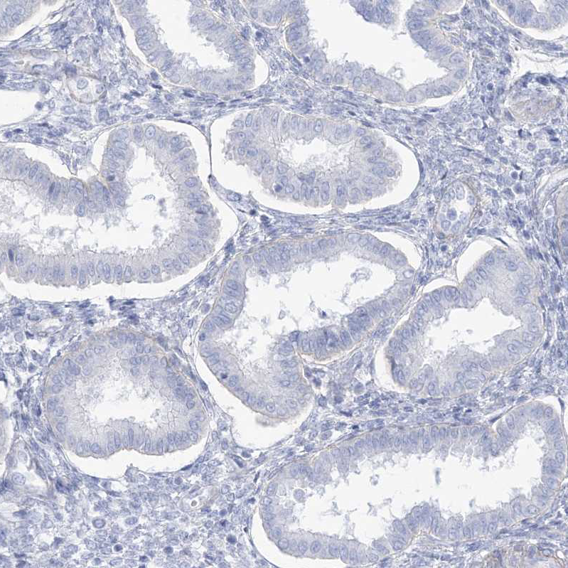 Immunohistochemistry (Formalin/PFA-fixed paraffin-embedded sections) - Anti-AGXT antibody (AB244450), expandable thumbnail