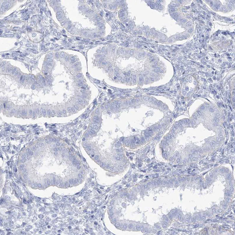 Immunohistochemistry (Formalin/PFA-fixed paraffin-embedded sections) - Anti-AGXT antibody (AB244450)