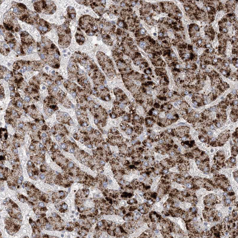 Immunohistochemistry (Formalin/PFA-fixed paraffin-embedded sections) - Anti-AGXT antibody (AB244450), expandable thumbnail