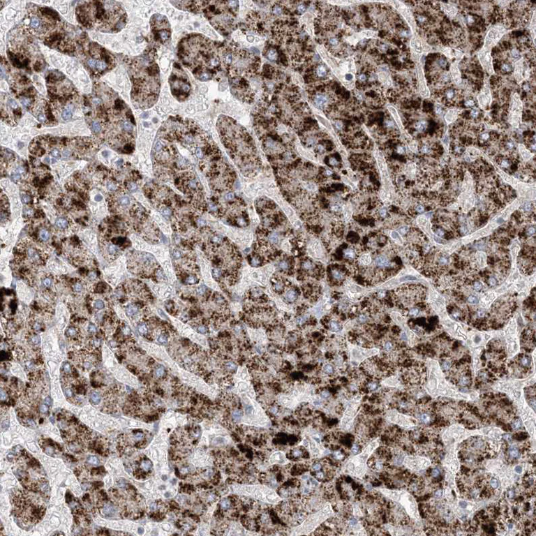 Immunohistochemistry (Formalin/PFA-fixed paraffin-embedded sections) - Anti-AGXT antibody (AB244450)