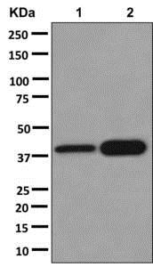 Western blot - Anti-AGXT antibody [EPR13232-59] - BSA and Azide free (AB250072), expandable thumbnail