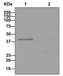 Immunoprecipitation - Anti-AGXT antibody [EPR13232] (AB178708)