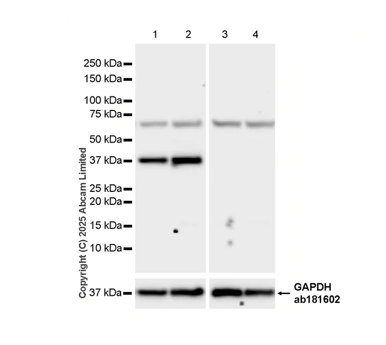 Western blot - Anti-AGXT antibody [EPR13232] (AB178708)
