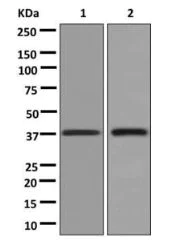 Western blot - Anti-AGXT antibody [EPR13232] - BSA and Azide free (AB250079)