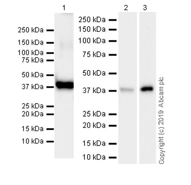 Western blot - Anti-AGXT antibody [EPR22885-58] (AB261910), expandable thumbnail