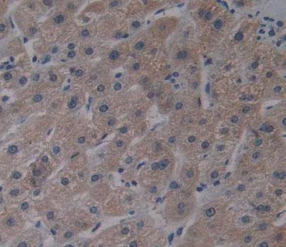 Immunohistochemistry (Formalin/PFA-fixed paraffin-embedded sections) - Anti-AGXT2 antibody (AB231815)