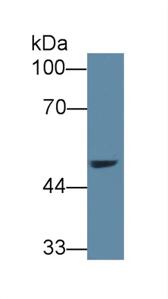 Western blot - Anti-AGXT2 antibody (AB231815)