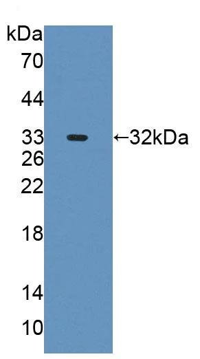 Western blot - Anti-AGXT2 antibody (AB231815)
